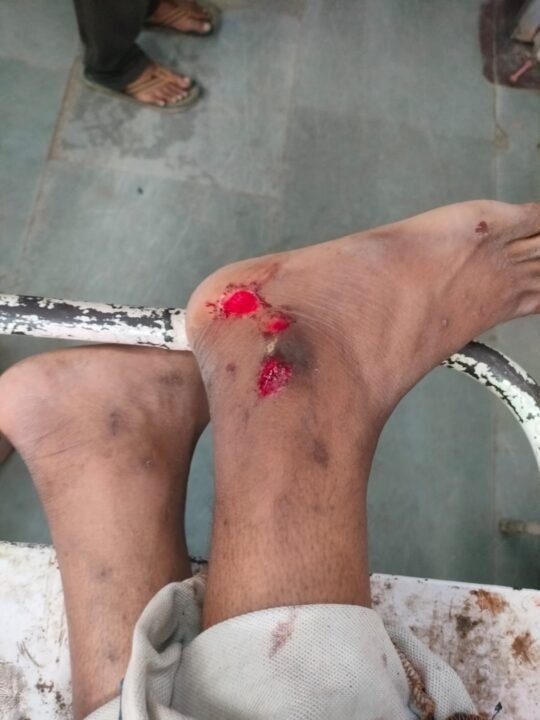 1001868185 कटनी-बरही मार्ग पर लूट की आशंका: सड़क पर बोल्डर रखे मिले, बाइक सवार घायल