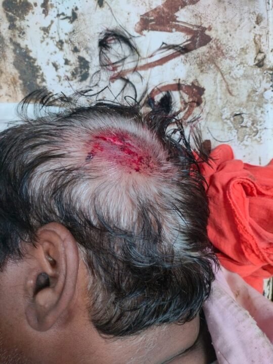 1001868187 कटनी-बरही मार्ग पर लूट की आशंका: सड़क पर बोल्डर रखे मिले, बाइक सवार घायल